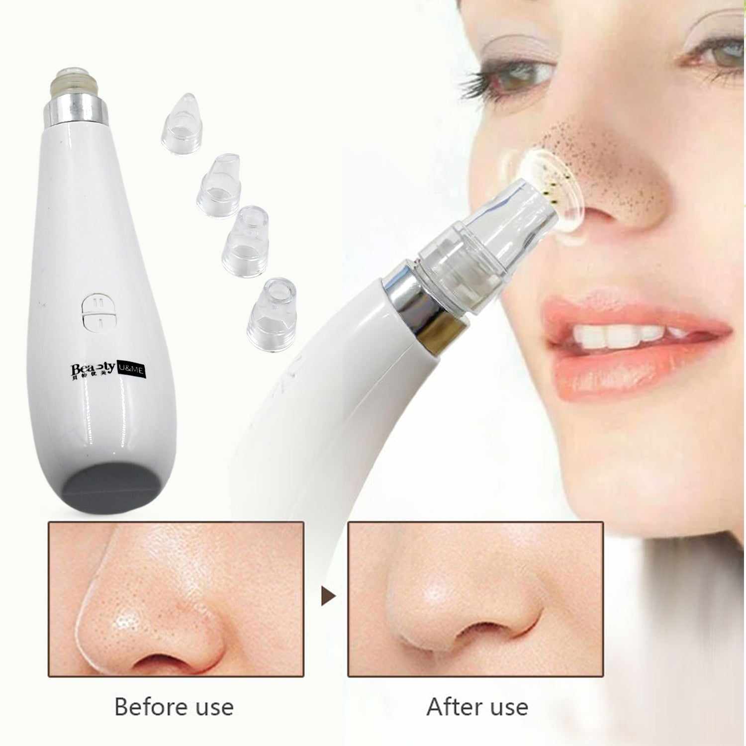 0351A Blackhead Remover Vacuum Suction Facial Pore Cleaner Dermabrasion Face Facial Pore Cleaner, Beauty Device kit with 4 Suction Probes for Women & Men Eshaan Traders